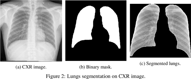 Figure 3 for Impact of lung segmentation on the diagnosis and explanation of COVID-19 in chest X-ray images