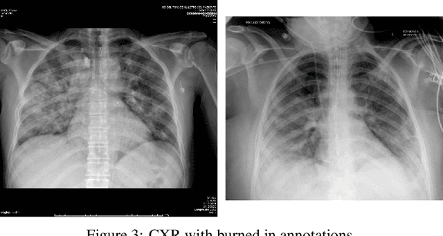 Figure 4 for Impact of lung segmentation on the diagnosis and explanation of COVID-19 in chest X-ray images