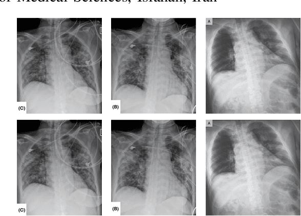 Figure 1 for Deep-COVID: Predicting COVID-19 From Chest X-Ray Images Using Deep Transfer Learning
