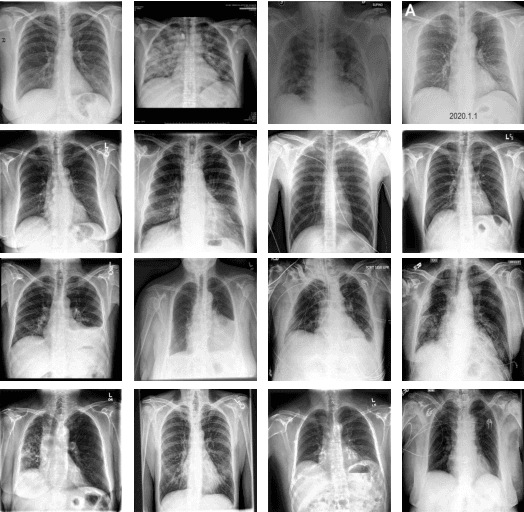 Figure 4 for Deep-COVID: Predicting COVID-19 From Chest X-Ray Images Using Deep Transfer Learning
