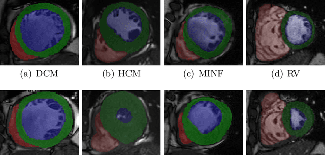 Figure 1 for A Radiomics Approach to Computer-Aided Diagnosis with Cardiac Cine-MRI