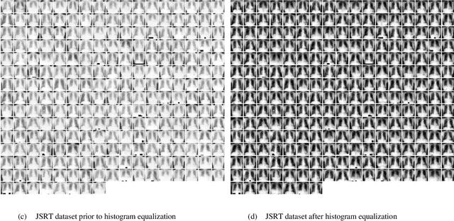 Figure 4 for Debiasing pipeline improves deep learning model generalization for X-ray based lung nodule detection
