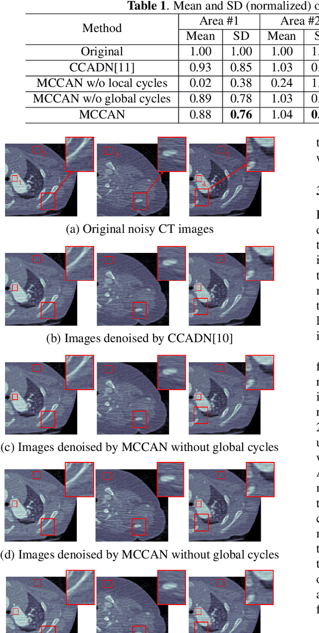 Figure 2 for Multi-Cycle-Consistent Adversarial Networks for CT Image Denoising