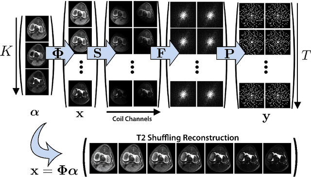 Figure 2 for Clinically Deployed Distributed Magnetic Resonance Imaging Reconstruction: Application to Pediatric Knee Imaging