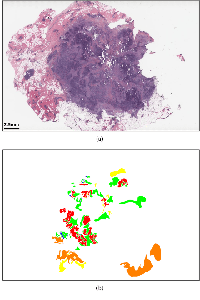 Figure 3 for Deep Multi-Magnification Networks for Multi-Class Breast Cancer Image Segmentation