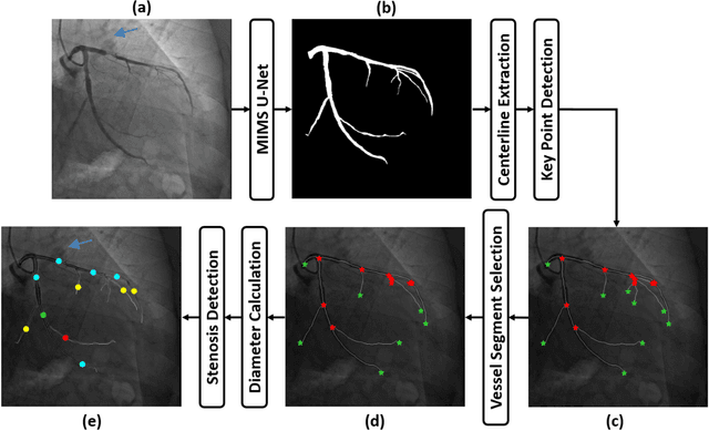 Figure 3 for A new approach to extracting coronary arteries and detecting stenosis in invasive coronary angiograms