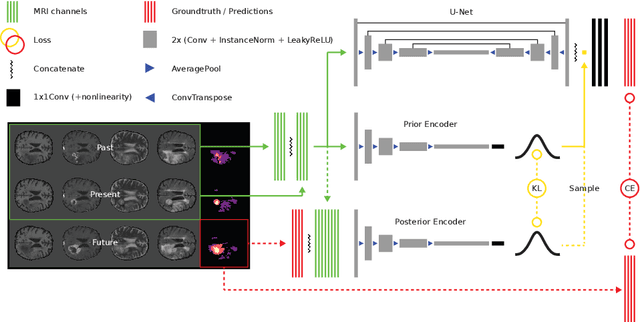 Figure 1 for Deep Probabilistic Modeling of Glioma Growth