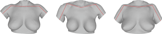 Figure 1 for Learning the shape of female breasts: an open-access 3D statistical shape model of the female breast built from 110 breast scans
