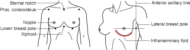 Figure 3 for Learning the shape of female breasts: an open-access 3D statistical shape model of the female breast built from 110 breast scans