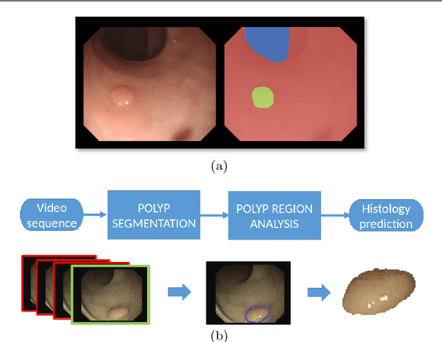 Figure 1 for A Benchmark for Endoluminal Scene Segmentation of Colonoscopy Images