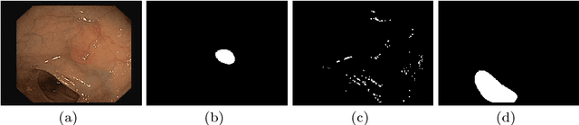 Figure 3 for A Benchmark for Endoluminal Scene Segmentation of Colonoscopy Images