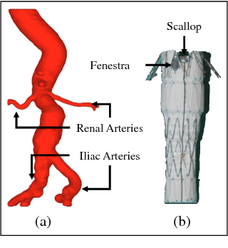 Figure 1 for 3D Path Planning from a Single 2D Fluoroscopic Image for Robot Assisted Fenestrated Endovascular Aortic Repair