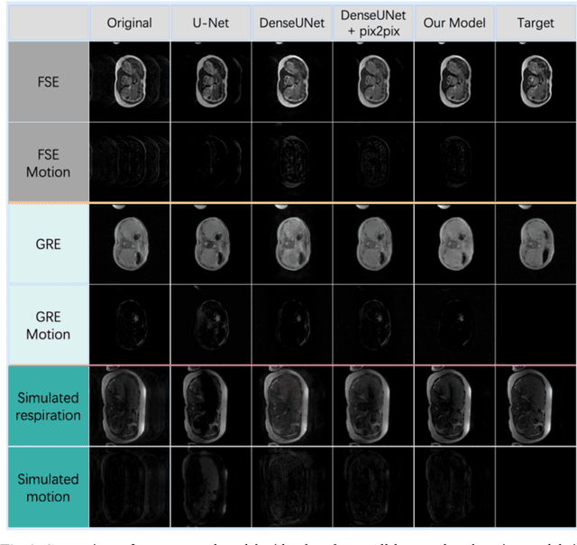 Figure 3 for Respiratory Motion Correction in Abdominal MRI using a Densely Connected U-Net with GAN-guided Training