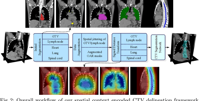 Figure 3 for Deep Esophageal Clinical Target Volume Delineation using Encoded 3D Spatial Context of Tumors, Lymph Nodes, and Organs At Risk