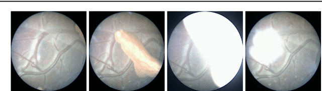 Figure 1 for Retrieval and Registration of Long-Range Overlapping Frames for Scalable Mosaicking of In Vivo Fetoscopy
