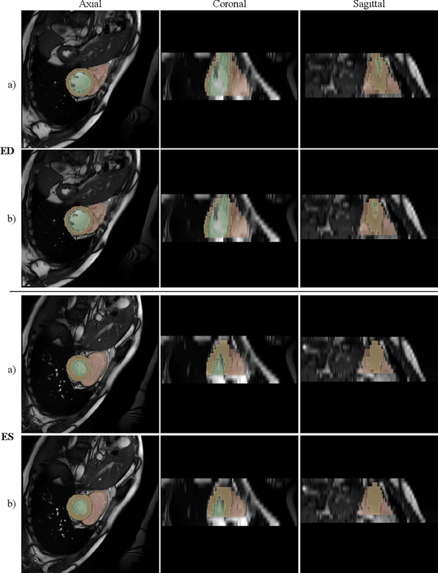 Figure 4 for Multi-task Swin Transformer for Motion Artifacts Classification and Cardiac Magnetic Resonance Image Segmentation