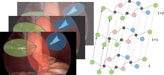 Figure 1 for Concept Graph Neural Networks for Surgical Video Understanding