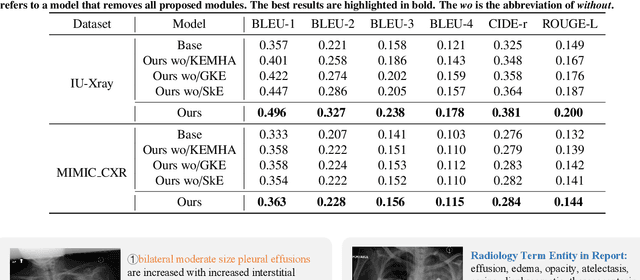 Figure 4 for Knowledge Matters: Radiology Report Generation with General and Specific Knowledge