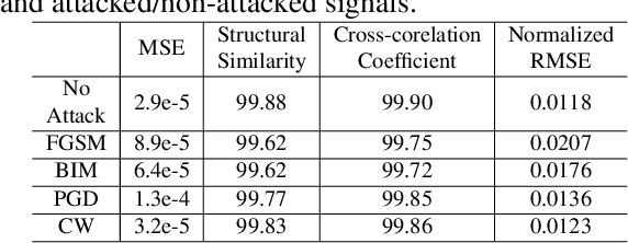 Figure 4 for ECG-ATK-GAN: Robustness against Adversarial Attacks on ECG using Conditional Generative Adversarial Networks