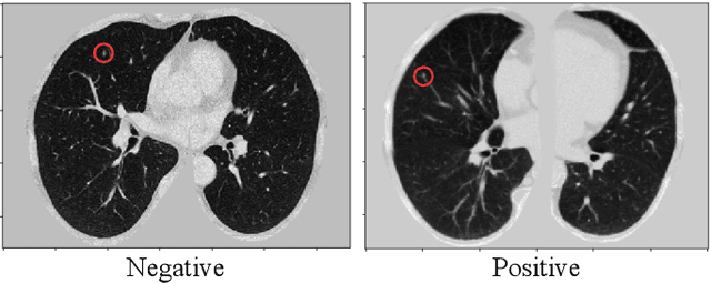 Figure 1 for 3D Aggregated Faster R-CNN for General Lesion Detection