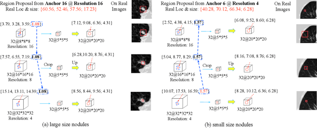 Figure 3 for 3D Aggregated Faster R-CNN for General Lesion Detection