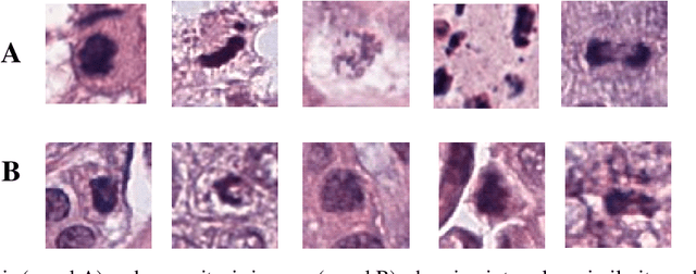 Figure 1 for Deep Object Detection based Mitosis Analysis in Breast Cancer Histopathological Images