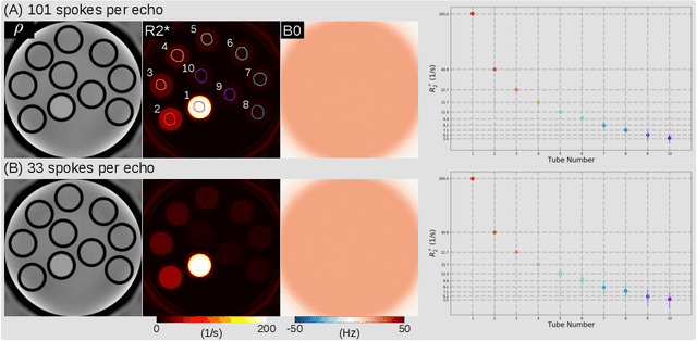 Figure 3 for Free-Breathing Water, Fat, $R_2^{\star}$ and $B_0$ Field Mapping of the Liver Using Multi-Echo Radial FLASH and Regularized Model-based Reconstruction (MERLOT)