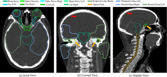 Figure 1 for Automatic Segmentation of Organs-at-Risk from Head-and-Neck CT using Separable Convolutional Neural Network with Hard-Region-Weighted Loss