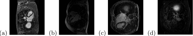 Figure 1 for UGformer for Robust Left Atrium and Scar Segmentation Across Scanners
