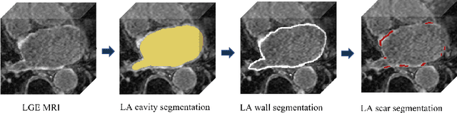 Figure 3 for UGformer for Robust Left Atrium and Scar Segmentation Across Scanners