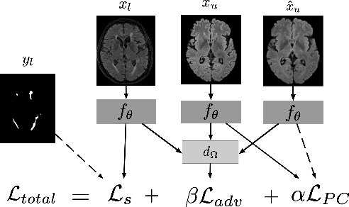Figure 1 for Multi-Domain Adaptation in Brain MRI through Paired Consistency and Adversarial Learning