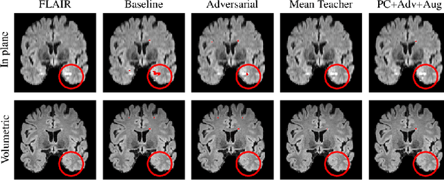 Figure 3 for Multi-Domain Adaptation in Brain MRI through Paired Consistency and Adversarial Learning