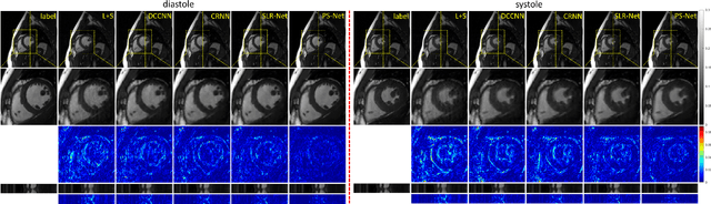 Figure 2 for PS-Net: Deep Partially Separable Modelling for Dynamic Magnetic Resonance Imaging