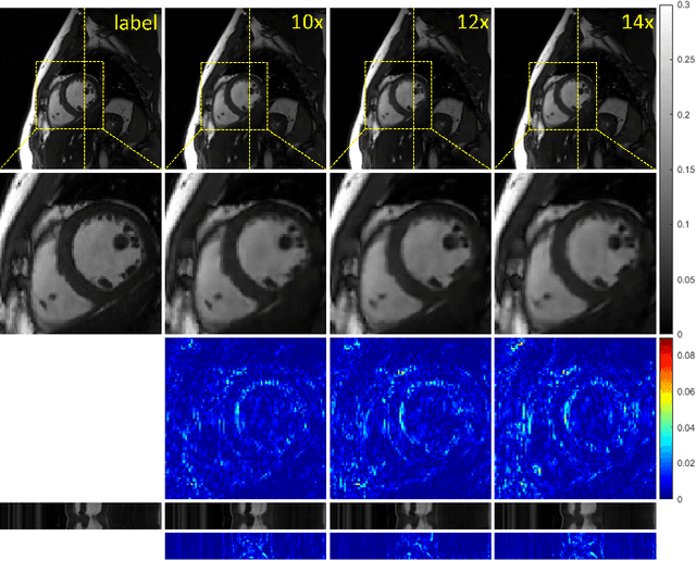 Figure 3 for PS-Net: Deep Partially Separable Modelling for Dynamic Magnetic Resonance Imaging
