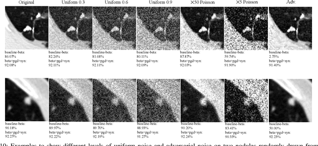 Figure 2 for No Surprises: Training Robust Lung Nodule Detection for Low-Dose CT Scans by Augmenting with Adversarial Attacks
