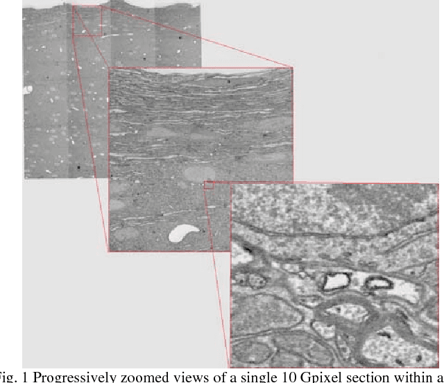 Figure 1 for Registering large volume serial-section electron microscopy image sets for neural circuit reconstruction using FFT signal whitening