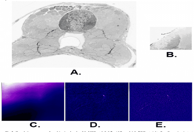 Figure 2 for Registering large volume serial-section electron microscopy image sets for neural circuit reconstruction using FFT signal whitening