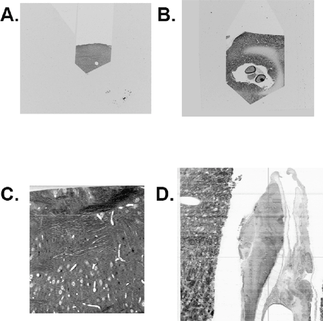 Figure 3 for Registering large volume serial-section electron microscopy image sets for neural circuit reconstruction using FFT signal whitening