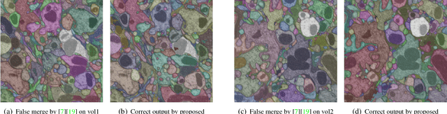 Figure 3 for What Properties are Desirable from an Electron Microscopy Segmentation Algorithm