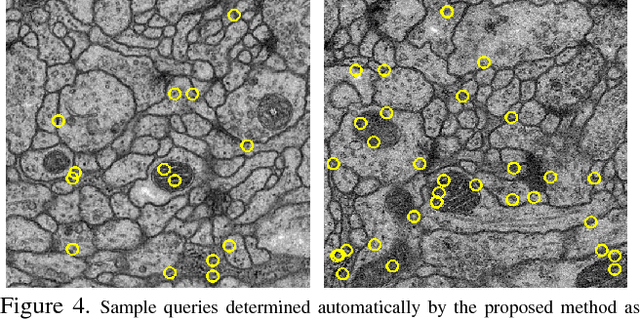 Figure 4 for What Properties are Desirable from an Electron Microscopy Segmentation Algorithm