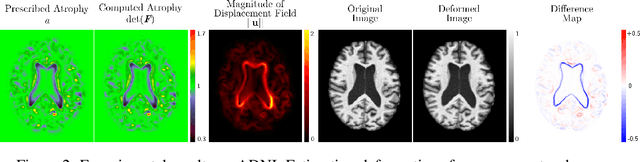 Figure 3 for Biomechanical modelling of brain atrophy through deep learning