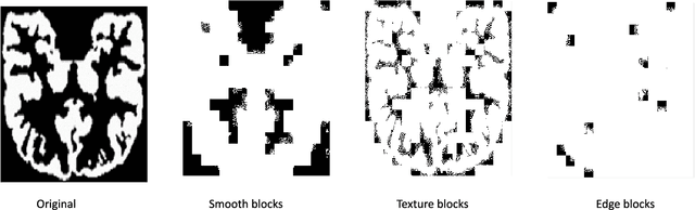 Figure 3 for Super-Resolution of Brain MRI Images using Overcomplete Dictionaries and Nonlocal Similarity