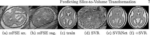 Figure 4 for Predicting Slice-to-Volume Transformation in Presence of Arbitrary Subject Motion