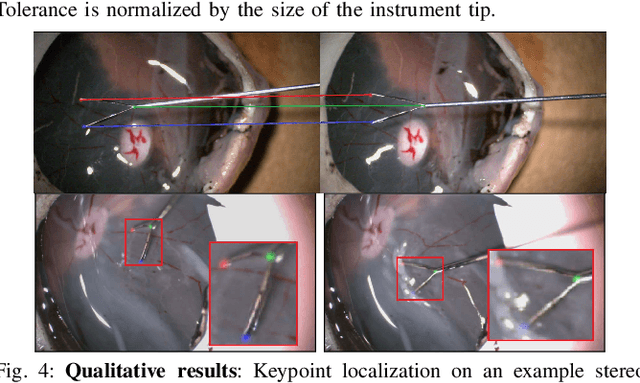 Figure 4 for Automatic Tool Landmark Detection for Stereo Vision in Robot-Assisted Retinal Surgery
