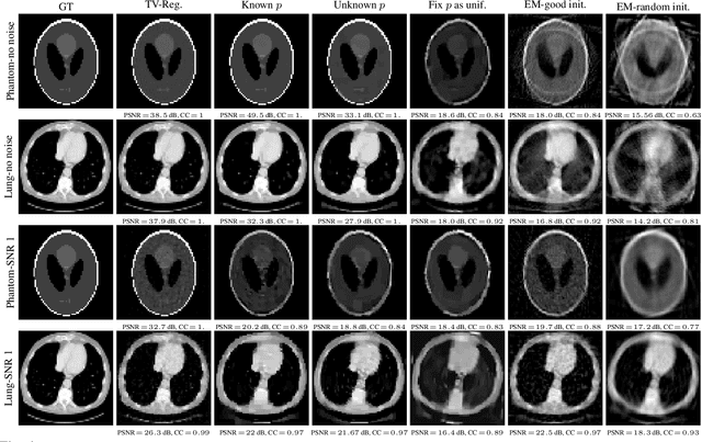 Figure 4 for UVTomo-GAN: An adversarial learning based approach for unknown view X-ray tomographic reconstruction