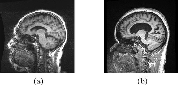 Figure 1 for Estimating MRI Image Quality via Image Reconstruction Uncertainty