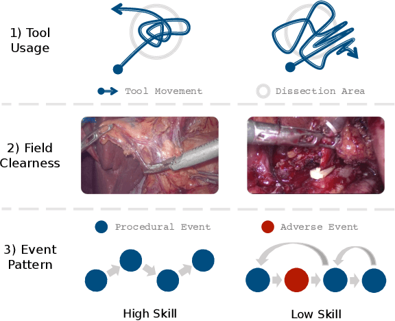 Figure 1 for Towards Unified Surgical Skill Assessment