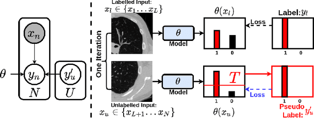 Figure 1 for Bayesian Pseudo Labels: Expectation Maximization for Robust and Efficient Semi-Supervised Segmentation