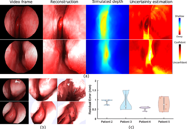 Figure 2 for Self-supervised Dense 3D Reconstruction from Monocular Endoscopic Video