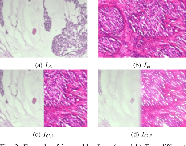 Figure 2 for Data Augmentation for Histopathological Images Based on Gaussian-Laplacian Pyramid Blending